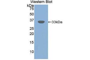 Image no. 1 for anti-Transforming Growth Factor, beta Receptor III (TGFBR3) (AA 210-465) antibody (ABIN1860735)