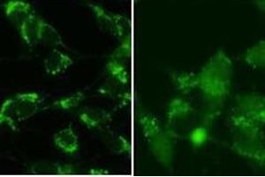 Image no. 2 for anti-Microtubule-Associated Protein 1 Light Chain 3 beta (MAP1LC3B) (AA 89-122), (cleaved) antibody (ABIN388484)