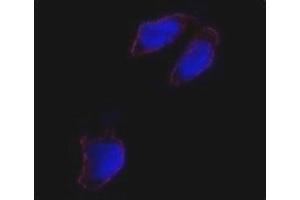 Immunofluorescence analysis of Oct4 antibody and HeLa cells.