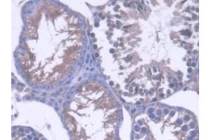 Image no. 2 for anti-Osteosarcoma Amplified 9, Endoplasmic Reticulum Lectin (OS9) (AA 471-672) antibody (ABIN5014065)