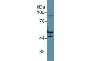 Image no. 2 for anti-Keratin 16 (KRT16) (AA 117-419) antibody (ABIN1172993)