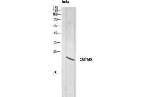 Image no. 2 for anti-CKLF-Like MARVEL Transmembrane Domain Containing 8 (CMTM8) antibody (ABIN3181749)