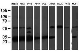 Image no. 10 for anti-Proteasome (Prosome, Macropain) Subunit, beta Type, 7 (PSMB7) (AA 58-277) antibody (ABIN1491598)