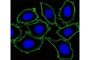 Image no. 4 for anti-Mast/stem Cell Growth Factor Receptor (KIT) antibody (ABIN3028783)