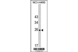 Image no. 1 for anti-FK506 Binding Protein 14, 22 KDa (FKBP14) (N-Term) antibody (ABIN2436888)