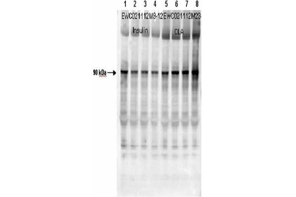 anti-Glycogen Synthase 1 (Muscle) (GYS1) (pSer640) antibody