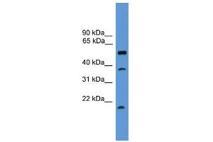 Image no. 1 for anti-serine Peptidase Inhibitor, Kunitz Type, 2 (SPINT2) (Middle Region) antibody (ABIN2787961)
