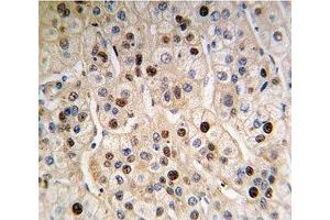 Image no. 1 for anti-Proliferating Cell Nuclear Antigen (PCNA) (AA 89-117) antibody (ABIN3032322)