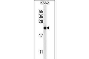 CHAC2 anticorps  (AA 61-89)