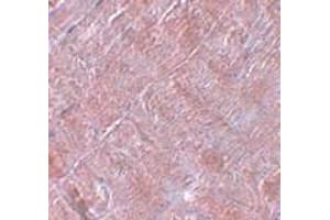 Immunohistochemistry (IHC) image for anti-RAN Binding Protein 10 (RANBP10) (Middle Region) antibody (ABIN1031052)