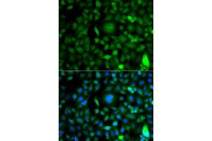 Image no. 2 for anti-D4, Zinc and Double PHD Fingers Family 1 (DPF1) antibody (ABIN4903505)