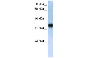 Image no. 1 for anti-Zinc Finger, CCHC Domain Containing 17 (ZCCHC17) (C-Term) antibody (ABIN2775234)
