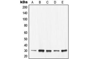 Image no. 2 for anti-14-3-3 epsilon (YWHAE) (C-Term) antibody (ABIN2704425)