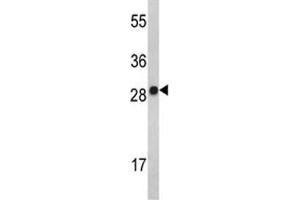 Image no. 2 for anti-Interleukin 2 (IL2) (AA 50-77) antibody (ABIN3031467)