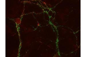 Indirect immunostaining of PFA fixed cultured hippocampus neurons with anti-SV2 C (dilution 1 : 500; red) and mouse anti-synapsin 1 (cat.