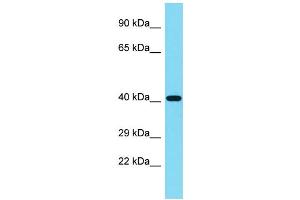Image no. 1 for anti-Ribosomal Modification Protein RimK-Like Family Member B (RIMKLB) (N-Term) antibody (ABIN2787225)
