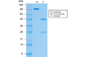 Image no. 4 for anti-Keratin 19 (KRT19) antibody (ABIN6939940)
