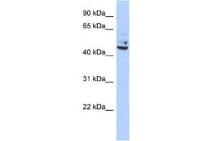 Image no. 1 for anti-Tumor Protein P53 Inducible Protein 13 (TP53I13) antibody (ABIN2459492)
