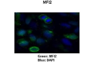 Image no. 2 for anti-Antigen P97 (Melanoma Associated) Identified By Monoclonal Antibodies 133.2 and 96.5 (MFI2) (C-Term) antibody (ABIN2774284)