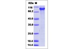 Image no. 1 for Checkpoint Kinase 2 (CHEK2) (AA 1-543) protein (GST tag) (ABIN5499790)