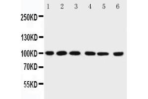 Image no. 9 for anti-Protein Inhibitor of Activated STAT, 1 (PIAS1) (AA 636-651) antibody (ABIN3032369)