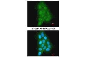 Image no. 3 for anti-Melanoma Antigen Family A, 11 (MAGEA11) (N-Term) antibody (ABIN2856757)