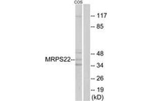 Image no. 1 for anti-Mitochondrial Ribosomal Protein S22 (MRPS22) (AA 231-280) antibody (ABIN1535022)