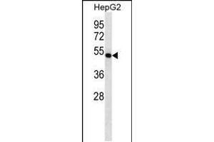 Image no. 1 for anti-Farnesyl-Diphosphate Farnesyltransferase 1 (FDFT1) (AA 332-361), (C-Term) antibody (ABIN5534290)