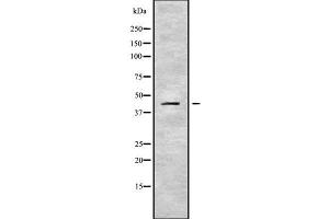 Image no. 1 for anti-serpin Peptidase Inhibitor, Clade B (Ovalbumin), Member 10 (SERPINB10) (Internal Region) antibody (ABIN6265006)