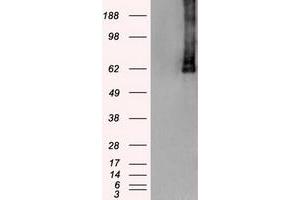 Image no. 2 for anti-Polo-Like Kinase 1 (PLK1) antibody (ABIN1500279)