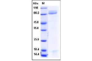 Image no. 1 for Pepsinogen 4, Group I (Pepsinogen A) (PGA4) (AA 1-388) (Active) protein (Fc Tag) (ABIN2005411)