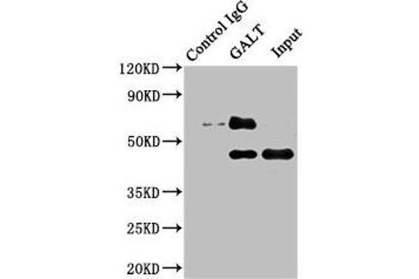 GALT antibody  (AA 1-379)