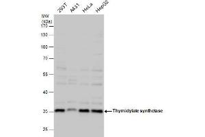Image no. 6 for anti-Thymidylate Synthetase (TYMS) (Center) antibody (ABIN2855587)