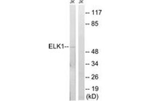 Image no. 1 for anti-ELK1, Member of ETS Oncogene Family (ELK1) (AA 351-400) antibody (ABIN1532857)