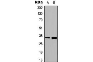 Image no. 3 for anti-Heterogeneous Nuclear Ribonucleoprotein A2/B1 (HNRNPA2B1) (N-Term) antibody (ABIN2707577)