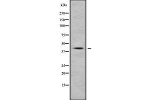 Image no. 1 for anti-Nuclear Factor of kappa Light Polypeptide Gene Enhancer in B-Cells Inhibitor-Like 1 (NFKBIL1) (Internal Region) antibody (ABIN6263629)