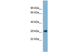 Image no. 1 for anti-Prkr Interacting Protein 1 (IL11 Inducible) (PRKRIP1) (N-Term) antibody (ABIN2787836)
