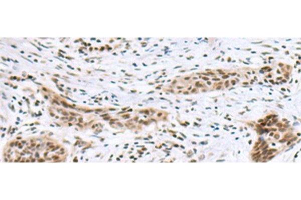 INSM1 antibody