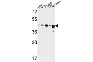 Image no. 4 for anti-Alcohol Dehydrogenase 7 (Class IV), mu Or sigma Polypeptide (ADH7) (AA 325-354), (C-Term) antibody (ABIN950340)