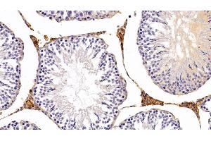 Leptin antibody  (AA 22-167)