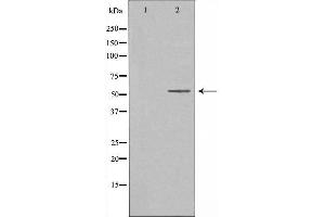 Image no. 1 for anti-CAMP Responsive Element Binding Protein 3-Like 2 (CREB3L2) antibody (ABIN6257984)