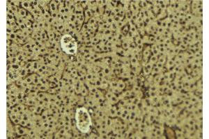 SH3BGRL3 antibody  (Internal Region)