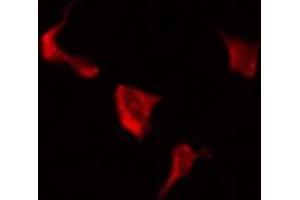 Image no. 1 for anti-Low Density Lipoprotein Receptor-Related Protein 3 (LRP3) (C-Term) antibody (ABIN6258254)