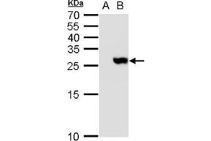 Image no. 1 for anti-PYD and CARD Domain Containing (PYCARD) (Center) antibody (ABIN2855403)