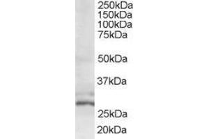 Image no. 1 for anti-HIV-1 Tat Interactive Protein 2, 30kDa (HTATIP2) (N-Term) antibody (ABIN185205)
