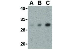 Image no. 3 for anti-Cell Death-Inducing DFFA-Like Effector B (CIDEB) (Internal Region) antibody (ABIN6656669)