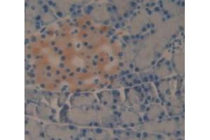 Image no. 3 for anti-Pancreatic Lipase (PNLIP) (AA 47-280) antibody (ABIN1859669)