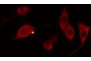 Image no. 3 for anti-Acyl-CoA Wax Alcohol Acyltransferase 1 (AWAT1) antibody (ABIN6260160)