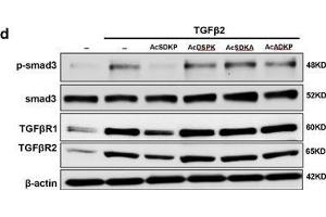 Image no. 5 for anti-SMAD, Mothers Against DPP Homolog 3 (SMAD3) (AA 417-425), (pSer423), (pSer425) antibody (ABIN129675)