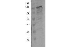 Image no. 4 for anti-Ewing Sarcoma Breakpoint Region 1 (EWSR1) (Middle Region) antibody (ABIN2779045)